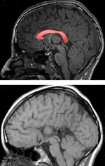 cerveau
